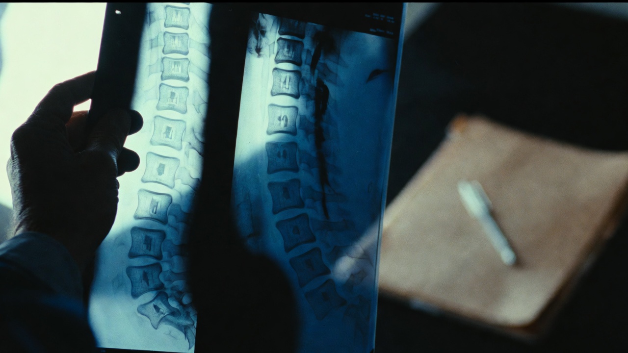 Reviewing spinal imaging to document a federal workers' compensation injury under FECA